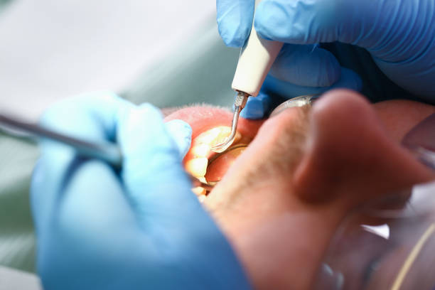 Best Emergency Treatment for Toothache in East Chicago, IN